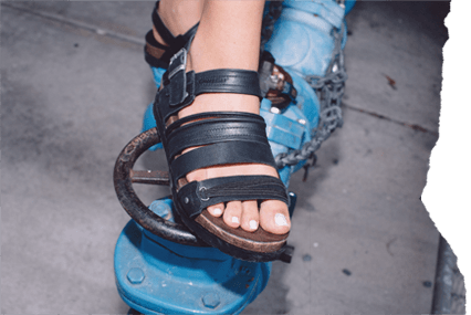 Sandal Tear